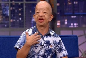 Bruno Diferente Age, Height, Wiki, Net Worth, Disorder