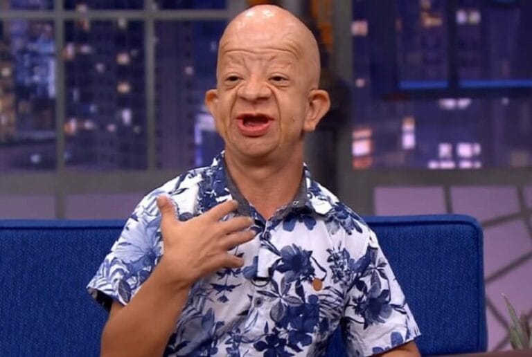 bruno-diferente-age-height-wiki-net-worth-disorder